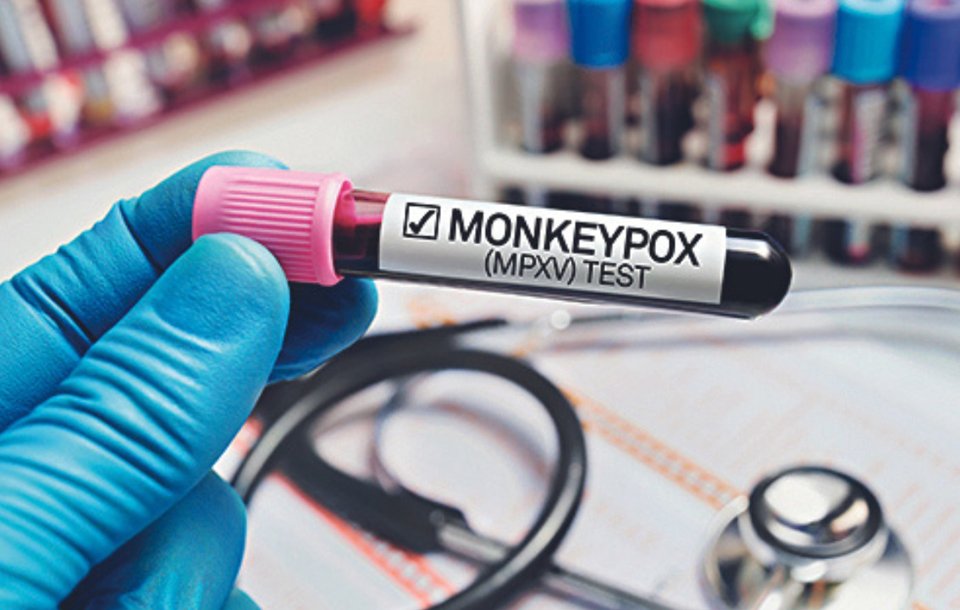 India orders health screening at ports, airports to minimise risk of monkeypox